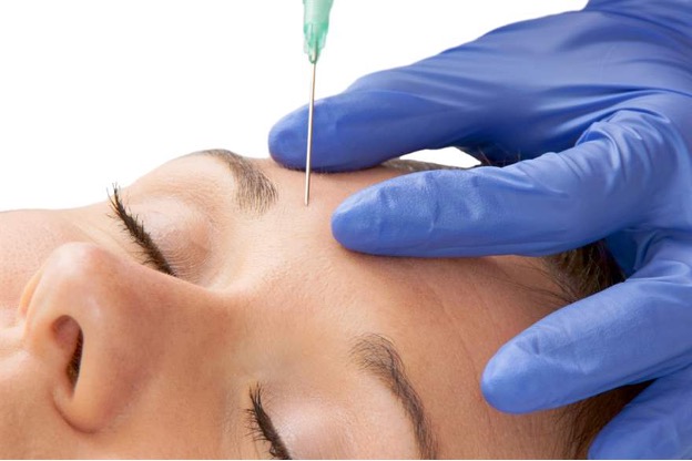 Things To Know Before Botox Treatment